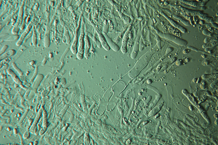 Plasmodio vs Phanerochaete?-foto3517(Hyphoderma roseocremeum